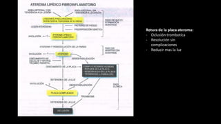 Rotura de la placa ateroma:
- Oclusión trombotica
- Resolución sin
complicaciones
- Reducir mas la luz
 