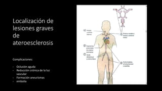 Localización de
lesiones graves
de
ateroesclerosis
Complicaciones:
- Oclusión aguda
- Reducción crónica de la luz
vascular
- Formación aneurismas
- embolia
 