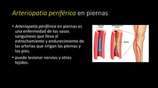 Arteriopatía periférica en piernas
• Arteriopatía periférica en piernas es
una enfermedad de los vasos
sanguíneos que lleva al
estrechamiento y endurecimiento de
las arterias que irrigan las piernas y
los pies.
• puede lesionar nervios y otros
tejidos.
 