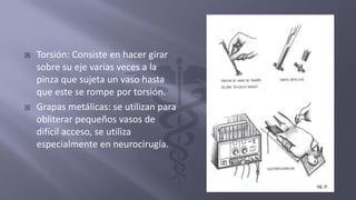  Torsión: Consiste en hacer girar
sobre su eje varias veces a la
pinza que sujeta un vaso hasta
que este se rompe por torsión.
 Grapas metálicas: se utilizan para
obliterar pequeños vasos de
difícil acceso, se utiliza
especialmente en neurocirugía.
 