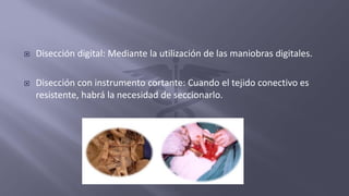  Disección digital: Mediante la utilización de las maniobras digitales.
 Disección con instrumento cortante: Cuando el tejido conectivo es
resistente, habrá la necesidad de seccionarlo.
 