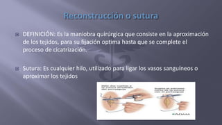  DEFINICIÓN: Es la maniobra quirúrgica que consiste en la aproximación
de los tejidos, para su fijación optima hasta que se complete el
proceso de cicatrización.
 Sutura: Es cualquier hilo, utilizado para ligar los vasos sanguíneos o
aproximar los tejidos
 