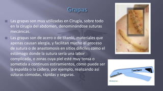  Las grapas son muy utilizadas en Cirugía, sobre todo
en la cirugía del abdomen, denominándose suturas
mecánicas.
 Las grapas son de acero o de titanio, materiales que
apenas causan alergia, y facilitan mucho el proceso
de sutura o de anastomosis en sitios difíciles como el
estómago donde la sutura sería una labor
complicada, o zonas cuya piel esté muy tensa o
sometida a continuos estiramientos, como puede ser
la espalda o la cadera, por ejemplo, realizando así
suturas cómodas, rápidas y seguras.
 