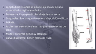  Longitudinal: Cuando se sigue el eje mayor de una
extremidad o región anatómica .
 Transversa: Es perpendicular al eje de una recta.
 Diagonales: Son las que tienen una disposición oblicua.
 FORMA
 Asciformes o semicirculares: las que tienen forma de
arco.
 Mixtas: en forma de S muy alargada.
 Curvas Fusiforme: tienen forma de Huso.
 