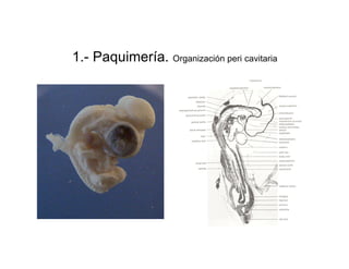 1.- Paquimería. Organización peri cavitaria