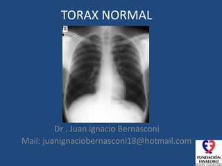 TORAX NORMAL
Dr . Juan ignacio Bernasconi
Mail: juanignaciobernasconi18@hotmail.com
 
