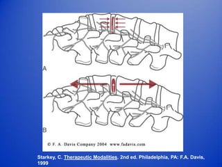 Starkey, C. Therapeutic Modalities. 2nd ed. Philadelphia, PA: F.A. Davis,
1999
 