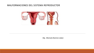 MALFORMACIONES DEL SISTEMA REPRODUCTOR
Mg . Marisela Ramirez Laban
 