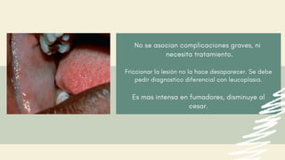 No se asocian complicaciones graves, ni
necesita tratamiento.
Friccionar la lesión no la hace desaparecer. Se debe
pedir diagnostico diferencial con leucoplasia.
Es mas intensa en fumadores, disminuye al
cesar.
 