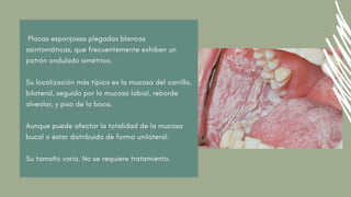 Placas esponjosas plegadas blancas
asintomáticas, que frecuentemente exhiben un
patrón ondulado simétrico.
Su localización más típica es la mucosa del carrillo,
bilateral, seguido por la mucosa labial, reborde
alveolar, y piso de la boca.
Aunque puede afectar la totalidad de la mucosa
bucal o estar distribuido de forma unilateral.
Su tamaño varia. No se requiere tratamiento.
 
