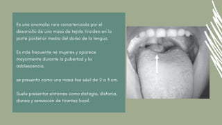 Es una anomalía rara caracterizada por el
desarrollo de una masa de tejido tiroideo en la
parte posterior media del dorso de la lengua.
Es más frecuente ne mujeres y aparece
mayormente durante la pubertad y la
adolescencia.
se presenta como una masa lisa sésil de 2 a 3 cm.
Suele presentar síntomas como disfagia, disfonia,
disnea y sensación de tirantez local.
 