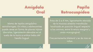 Islotes de tejidos amigdalino
extrafaríngeo. En niños y adolescentes
puede verse en forma de placas rojizas
discretas, ligeramente elevadas en el
suelo de la boca a ambos lados del
frenillo lingual.
Amígdala
Oral
Papila
Retrocuspídea
Área de 2 a 4 mm, ligeramente elevada
de la mucosa alveolar mandibular
localizada en posición lingual respecto
a los caninos, entre la encía marginal y
unión mucogingival.
Frecuentemente bilateral y se da mas en
niños.
 