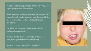 Puede afectar cualquier lado de la cara y hay una
ligera predilección por la mujer.
Suele existir un aumento unilateral del tamaño del
hueso frontal, maxilar superior, paladar, mandíbula,
proceso alveolar, condilos y tejidos blandos
asociados.
Debido a las asimetrías óseas y dentales la
malaoclusión es común.
Puede estar tambien aumentado de tamaño los
ojos, oidos y los hemisferios cerebrales.
A menudo existe macroglosia unilateral.
 