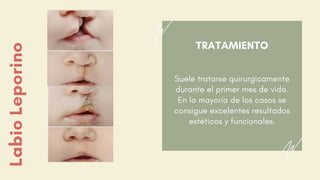 TRATAMIENTO
Suele tratarse quirurgicamente
durante el primer mes de vida.
En la mayoría de los casos se
consigue excelentes resultados
estéticos y funcionales.
LabioLeporino
 