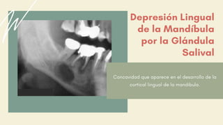 Depresión Lingual
de la Mandíbula
por la Glándula
Salival
Concavidad que aparece en el desarrollo de la
cortical lingual de la mandibula.
 