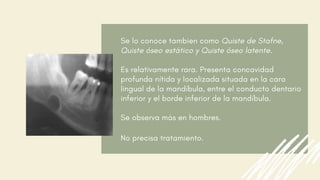Se lo conoce tambien como Quiste de Stafne,
Quiste óseo estático y Quiste óseo latente.
Es relativamente rara. Presenta concavidad
profunda nítida y localizada situada en la cara
lingual de la mandíbula, entre el conducto dentario
inferior y el borde inferior de la mandíbula.
Se observa más en hombres.
No precisa tratamiento.
 