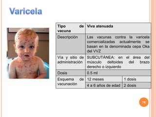 Tipo de
vacuna
Viva atenuada
Descripción Las vacunas contra la varicela
comercializadas actualmente se
basan en la denominada cepa Oka
del VVZ
Vía y sitio de
administración
SUBCUTÁNEA: en el área del
músculo deltoides del brazo
derecho o izquierdo
Dosis 0.5 ml
Esquema de
vacunación
12 meses 1 dosis
4 a 6 años de edad 2 dosis
76
 