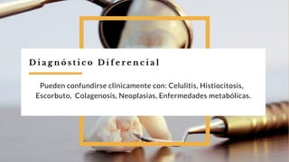 D i a g n ó s t i c o D i f e r e n c i a l
Pueden confundirse clínicamente con: Celulitis, Histiocitosis,
Escorbuto, Colagenosis, Neoplasias, Enfermedades metabólicas.
 