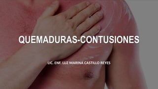 QUEMADURAS-CONTUSIONES
LIC. ENF. LUZ MARINA CASTILLO REYES
 