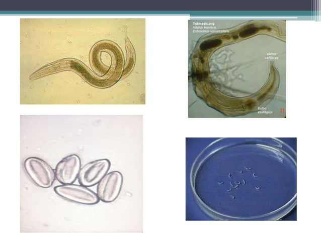 CLASIF. HELMINTOS (NEMATODOS PARASITÓLOGIA ).pptx | Biological Sciences ...