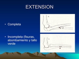 EXTENSION Completa Incompleta (fisuras, abombamiento y tallo verde 