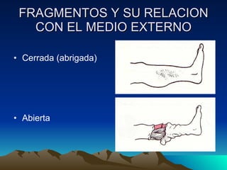 FRAGMENTOS Y SU RELACION CON EL MEDIO EXTERNO Cerrada (abrigada) Abierta 