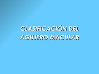 CLASIFICACIÓN DEL AGUJERO MACULAR 