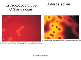 Estreptococo grupo C S.anginosus S.dysgalactiae 