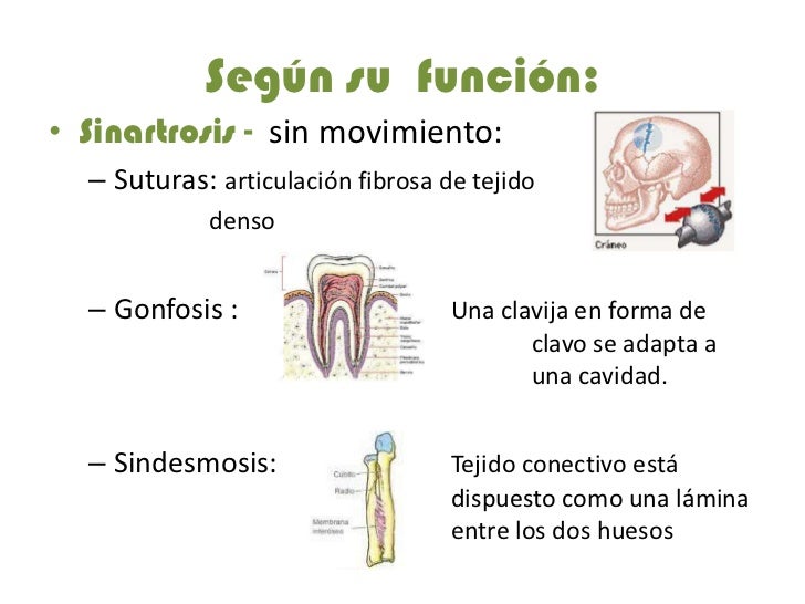 Clasificación articular