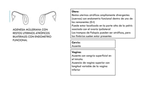 Clasificación de anomalías müllerianas ASRM 2021.pptx