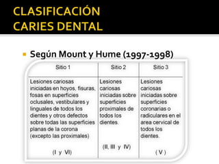 Mount Home Classification System Clasificación de caries dental | PPTX