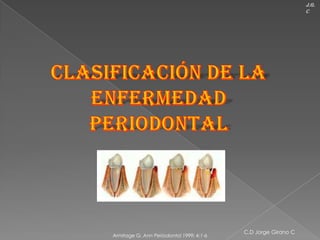 J.G.
                                                               C




                                          C.D Jorge Girano C
Armitage G. Ann Periodontol 1999; 4:1-6
 