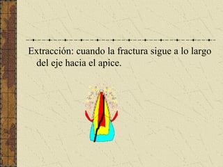 Extracción: cuando la fractura sigue a lo largo
del eje hacia el apice.
 