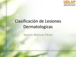 Clasificación de Lesiones
Dermatologicas
Yasmin Blancas Pérez
 