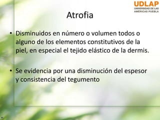 Atrofia
• Disminuidos en número o volumen todos o
alguno de los elementos constitutivos de la
piel, en especial el tejido elástico de la dermis.
• Se evidencia por una disminución del espesor
y consistencia del tegumento
 
