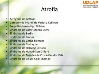 Atrofia
• Acrogeria de Gottron
• Gerodermia infantil de Variot y Cailleau
• Poiquililodermia tipo Gahlen
• Síndrome de Barsy-Moens-Dierx
• Síndrome de Berlin
• Síndrome de Bloom
• Síndrome de Christ-Siemens
• Sindrome de Cockayne
• Síndrome de Hellweg-Larssen
• Síndrome de Hutchinson-Gilford
• Síndrome de Mendes da Costa-Van der Valk
• Síndrome de Zinser-Cole-Engman
 