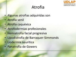 Atrofia
• Algunas atrofias adquiridas son
• Atrofia senil
• Atrofia caquéxica
• Atrofodermias profesionales
• Hemiatrofia facial progresiva
• Lipodistrofia de Barraquer-Simmonds
• Liodermia neurítica
• Panatrofia de Gowers
 