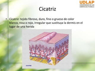 Cicatriz
• Cicatriz: tejido fibroso, duro, fino o grueso de color
blanco, rosa o rojo, irregular que sustituya la dermis en el
lugar de una herida
 