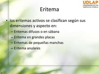Eritema
• los eritemas activos se clasifican según sus
dimensiones y aspecto en:
– Eritemas difusos o en sábana
– Eritema en grandes placas
– Eritemas de pequeñas manchas
– Eritema anulares
 
