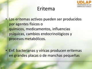Eritema
• Los eritemas activos pueden ser producidos
por agentes físicos o
químicos, medicamentos, influencias
psíquicas, cambios endocrinológicos y
procesos metabólicos.
• Enf. bacterianas y víricas producen eritemas
en grandes placas o de manchas pequeñas
 