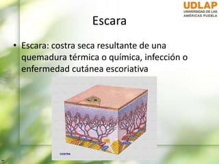 Escara
• Escara: costra seca resultante de una
quemadura térmica o química, infección o
enfermedad cutánea escoriativa
 