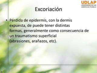 Excoriación
• Pérdida de epidermis, con la dermis
expuesta, de puede tener distintas
formas, generalmente como consecuencia de
un traumatismo superficial
(abrasiones, arañazos, etc).
 