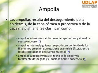 Ampolla
• Las ampollas resulta del despegamiento de la
epidermis, de la capa córnea o precornea o de la
capa malpighiana. Se clasifican como:
• ampollas subcórneas: el techo es la capa córnea y el suelo el
cuerpo mucoso (*)
• ampollas intermalpighianas: se producen por lesión de los
filamentos de unión que ocasiona acantolisis (fisuras entre
los distintos planos del cuerpo mucoso) (*)
• ampollas subepidérmicas: el techo es la epidermis
totalmente despegada y el suelo la dermis superficial (*)
 