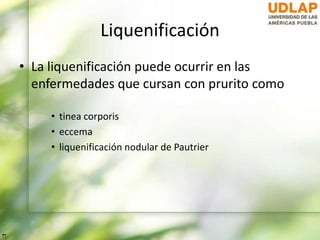 Liquenificación
• La liquenificación puede ocurrir en las
enfermedades que cursan con prurito como
• tinea corporis
• eccema
• liquenificación nodular de Pautrier
 