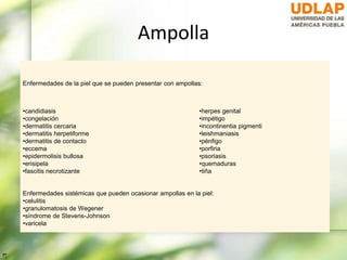 Ampolla
Enfermedades de la piel que se pueden presentar con ampollas:
•candidiasis
•congelación
•dermatitis cercaria
•dermatitis herpetiforme
•dermatitis de contacto
•eccema
•epidermolisis bullosa
•erisipela
•fascitis necrotizante
•herpes genital
•impétigo
•incontinentia pigmenti
•leishmaniasis
•pénfigo
•porfiria
•psoriasis
•quemaduras
•tiña
Enfermedades sistémicas que pueden ocasionar ampollas en la piel:
•celulitis
•granulomatosis de Wegener
•síndrome de Stevens-Johnson
•varicela
 