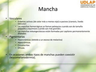 Mancha
• Vasculares
• Eritemas activos (de color más o menos rojo) o pasivos (cianosis, livedo
reticular)
• Las manchas hemorrágicas se llaman petequias cuando son de tamaño
pequeño y equimosis cuando son más grandes.
• Las manchas teleangectásicas están formadas por capilares permanentemente
dilatados
• Pigmentarias
• Hipercrómicas (debido a un exceso de melanina)
• Hipocrómicas.
• Circunscritas
• Difusas.
• En ocasiones ambas tipos de manchas pueden coexistir
(leucomelanodermia).
 