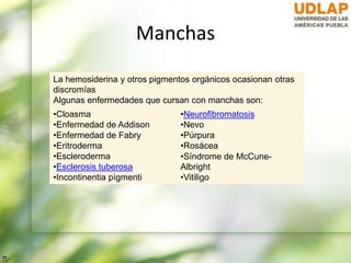 Manchas
La hemosiderina y otros pigmentos orgánicos ocasionan otras
discromías
Algunas enfermedades que cursan con manchas son:
•Cloasma
•Enfermedad de Addison
•Enfermedad de Fabry
•Eritroderma
•Escleroderma
•Esclerosis tuberosa
•Incontinentia pìgmenti
•Neurofibromatosis
•Nevo
•Púrpura
•Rosácea
•Síndrome de McCune-
Albright
•Vitiligo
 