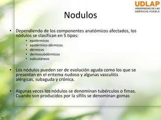 Nodulos
• Dependiendo de los componentes anatómicos afectados, los
nódulos se clasifican en 5 tipos:
• epidérmicos
• epidérmico-dérmicos
• dérmicos
• dermosubdérmicos
• subcutáneos
• Los nódulos pueden ser de evolución aguda como los que se
presentan en el eritema nudoso y algunas vasculitis
alérgicas, subaguda y crónica.
• Algunas veces los nódulos se denominan tubérculos o fimas.
Cuando son producidos por la sífilis se denominan gomas
 