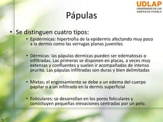 Pápulas
• Se distinguen cuatro tipos:
• Epidérmicas: hipertrofia de la epidermis afectando muy poco
a la dermis como las verrugas planas juveniles
• Dérmicas: las pápulas dermicas pueden ser edematosas o
infiltradas. Las primeras se disponen en placas, a veces muy
extensas y confluentes y suelen ir acompañadas de intenso
prurito. Las pápulas infiltradas son duras y bien delimitadas
• Mixtas; el engrosamiento se debe a un edema del cuerpo
papilar o a un infiltrado en la dermis superficial
• Foliculares: se desarrollan en los poros foliculares y
constituyen pequeñas elevaciones centradas por un pelo.
 