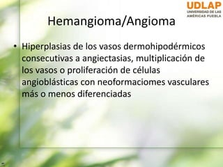 Hemangioma/Angioma
• Hiperplasias de los vasos dermohipodérmicos
consecutivas a angiectasias, multiplicación de
los vasos o proliferación de células
angioblásticas con neoformaciomes vasculares
más o menos diferenciadas
 